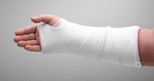 Kol Kırığının Nedenleri?