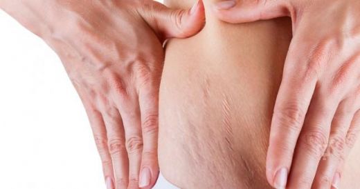 Omuz Çatlağı Belirtileri ve Tedavisi