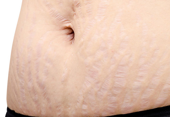 Çatlak Ameliyatı Riskleri ve Sonrası