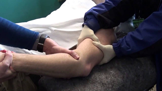 Dirsek Çatlağı Belirtileri ve Tedavisi